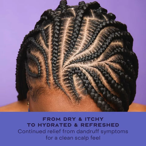 SheaMoisture Anti-Dandruff Spray - Apple Cider Vinegar & Niacinamide - 4 fl oz: Deep Hydration, Soothing, Nourishing, Dry Hair